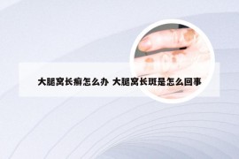 大腿窝长癣怎么办 大腿窝长斑是怎么回事