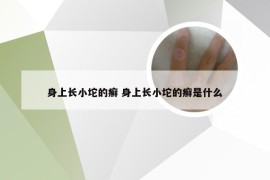 身上长小坨的癣 身上长小坨的癣是什么