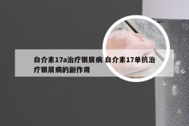 白介素17a治疗银屑病 白介素17单抗治疗银屑病的副作用