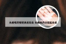 头癣喷药够把表皮扣去 头癣擦药以后起白皮