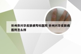 忻州市兴华皮肤病专科医院 忻州兴华皮肤病医院怎么样