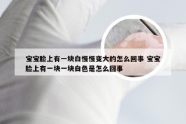 宝宝脸上有一块白慢慢变大的怎么回事 宝宝脸上有一块一块白色是怎么回事