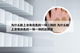 为什么脸上会有白色的一块一块的 为什么脸上会有白色的一块一块的还脱皮