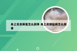 身上走皮癣是怎么回事 身上皮肤起癣怎么回事