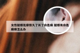 女性腿根处摩擦久了长了白色癣 腿根有白色癣痒怎么办