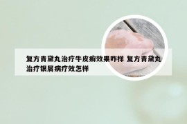 复方青黛丸治疗牛皮癣效果咋样 复方青黛丸治疗银屑病疗效怎样