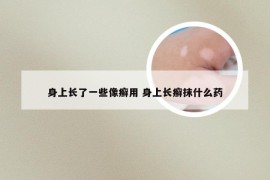 身上长了一些像癣用 身上长癣抹什么药