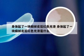 身体起了一块癣掉皮后红色光滑 身体起了一块癣掉皮后红色光滑是什么