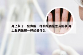 身上长了一些像癣一样的东西是怎么回事 身上起的像癣一样的是什么