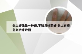 头上好像是一种癣,不知用啥药好 头上有癣怎么治疗妙招