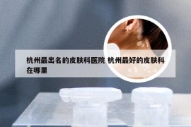 杭州最出名的皮肤科医院 杭州最好的皮肤科在哪里