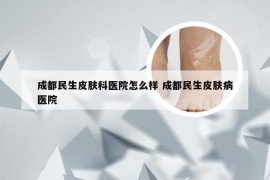 成都民生皮肤科医院怎么样 成都民生皮肤病医院