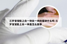 三岁宝宝脸上白一块白一块的是缺什么吗 三岁宝宝脸上白一块是怎么回事