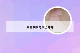 银屑病长龟头上咋办