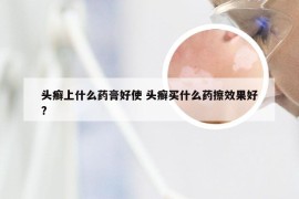 头癣上什么药膏好使 头癣买什么药擦效果好?