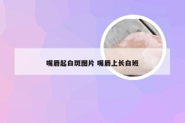 嘴唇起白斑图片 嘴唇上长白班