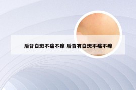 后背白斑不痛不痒 后背有白斑不痛不痒