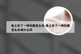 身上长了一块红癣怎么办 身上长了一块红癣怎么办用什么药