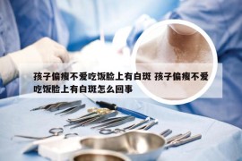 孩子偏瘦不爱吃饭脸上有白斑 孩子偏瘦不爱吃饭脸上有白斑怎么回事