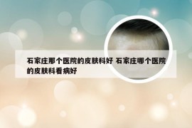 石家庄那个医院的皮肤科好 石家庄哪个医院的皮肤科看病好