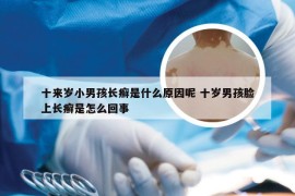 十来岁小男孩长癣是什么原因呢 十岁男孩脸上长癣是怎么回事