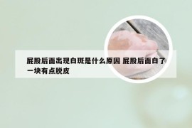 屁股后面出现白斑是什么原因 屁股后面白了一块有点脱皮