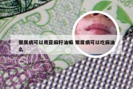 银屑病可以用亚麻籽油嘛 银屑病可以吃麻油么