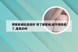 得银屑病比癌症好 得了银屑病,就不得癌症了,是真的吗