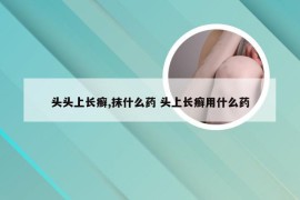 头头上长癣,抹什么药 头上长癣用什么药