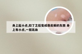 身上起小点,扣了之后变成像皮癣的东西 身上有小点,一抠出血