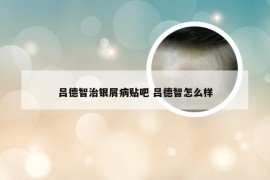 吕德智治银屑病贴吧 吕德智怎么样