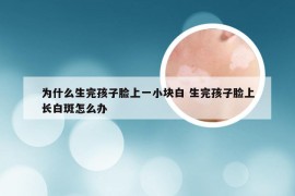 为什么生完孩子脸上一小块白 生完孩子脸上长白斑怎么办