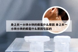 身上长一小块小块的癣是什么原因 身上长一小块小块的癣是什么原因引起的