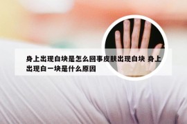 身上出现白块是怎么回事皮肤出现白块 身上出现白一块是什么原因