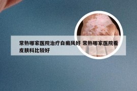 常熟哪家医院治疗白癜风好 常熟哪家医院看皮肤科比较好