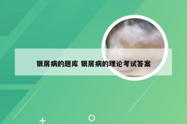 银屑病的题库 银屑病的理论考试答案