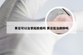 黄豆可以治掌跖脓疱吗 黄豆能治脚肿吗