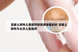 首都儿研所儿童医院银屑病谁看的好 首都儿研所与北京儿童医院