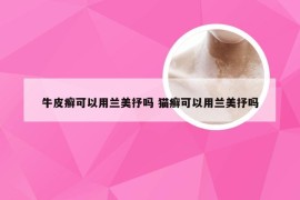 牛皮癣可以用兰美抒吗 猫癣可以用兰美抒吗