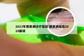 2023年银屑病诊疗指南 银屑病指南2018解读