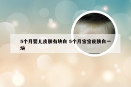 5个月婴儿皮肤有块白 5个月宝宝皮肤白一块