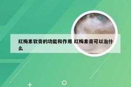 红梅素软膏的功能和作用 红梅素膏可以治什么