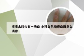 宝宝太阳穴有一块白 小孩白色糠疹白斑怎么消除