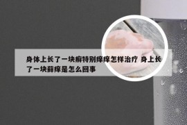 身体上长了一块癣特别痒痒怎样治疗 身上长了一块藓痒是怎么回事