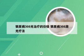 银屑病308光治疗的价格 银屑病308激光疗法