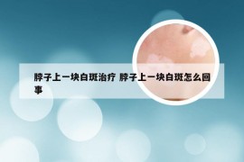 脖子上一块白斑治疗 脖子上一块白斑怎么回事