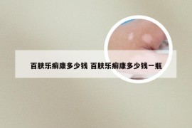 百肤乐癣康多少钱 百肤乐癣康多少钱一瓶