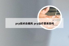 prp技术白癜风 prp治疗费用贵吗