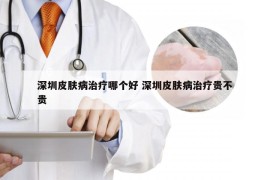 深圳皮肤病治疗哪个好 深圳皮肤病治疗贵不贵