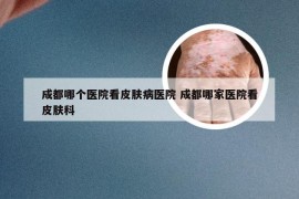 成都哪个医院看皮肤病医院 成都哪家医院看皮肤科